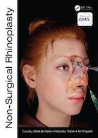 Non-Surgical Rhinoplasty (The PRIME Series) Kindle Edition | رینوپلاستی غیر جراحی